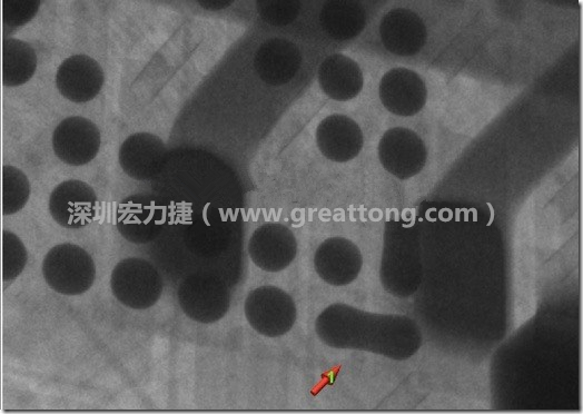 BGA因?yàn)楹笁|變小，造成錫膏過多而最終形成焊接短路的結(jié)果。